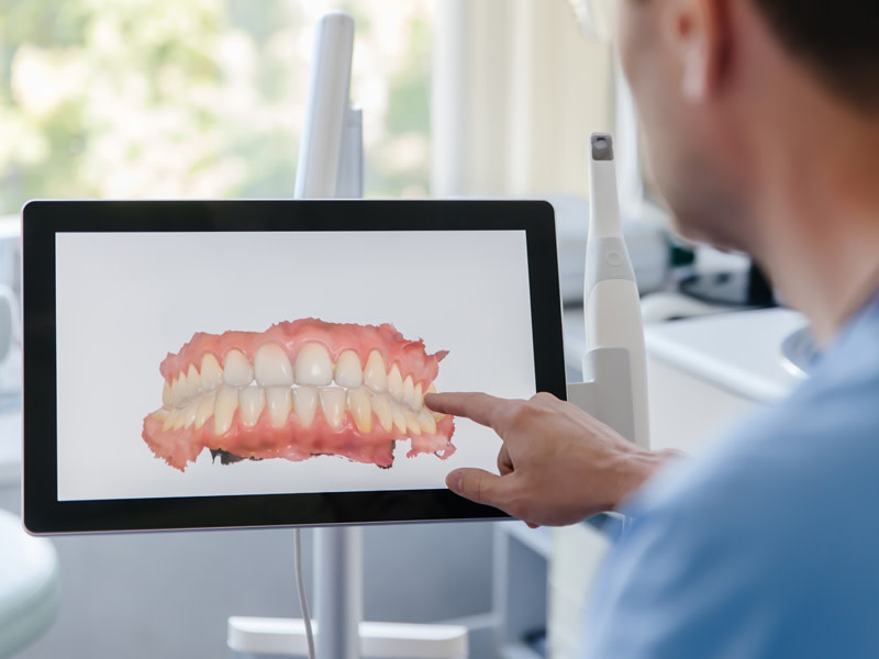 Resultado_de_un_esc_ner_dental_3D sca (1)